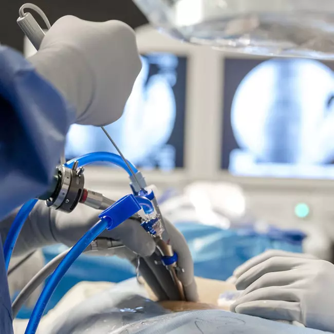 Dr. Alfredo Ortega Quiroz, Cirujano Ortopedista Traumatólogo, Alta Especialidad en Cirugía de Columna Vertebral