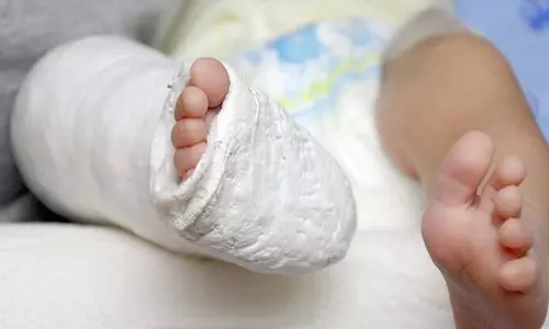 Dr. Alfredo Ortega Quiroz, Cirujano Ortopedista Traumatólogo, Alta Especialidad en Cirugía de Columna Vertebral